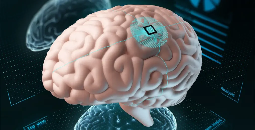 implantes cerebrales electrónicos